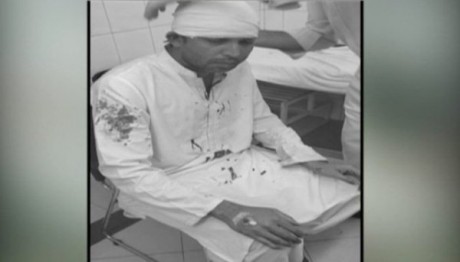 Muhammad Asif Accident